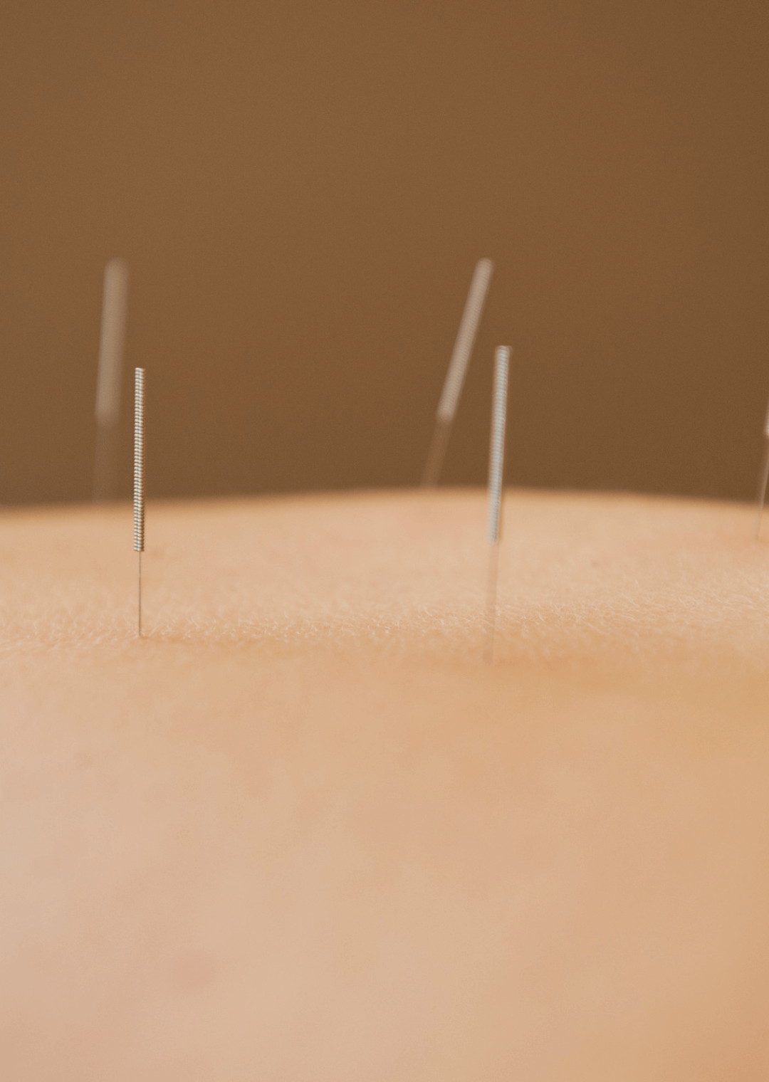 XVIII Curso ElectroNeuroAcupuntura